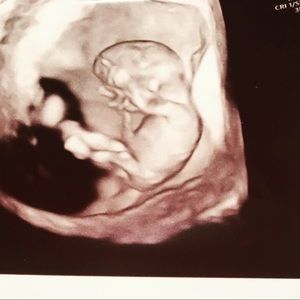 Meet your Posher, Wanda